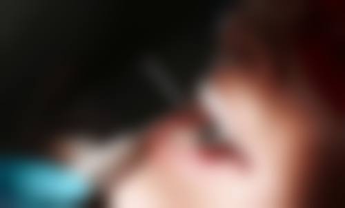 湖北省第三人民医院李荣华医生擅长项目