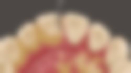 珠海市人民医院李荣华医生技术特色