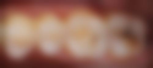 湖北省第三人民医院李荣华医生技术特色