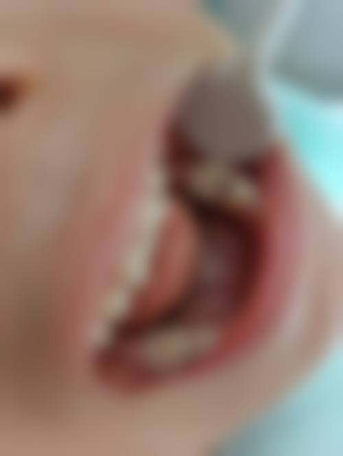 嘉兴艺星医疗美容医院李荣华医生怎么预约挂号