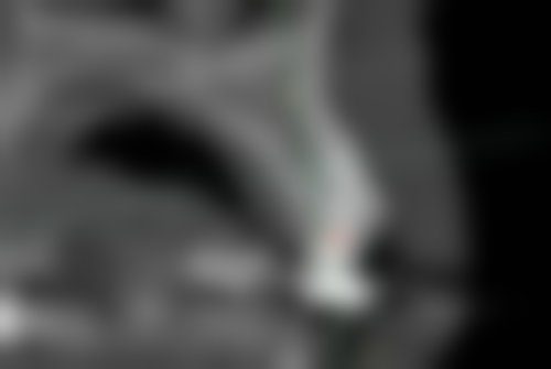 中日友好医院董静医生擅长项目