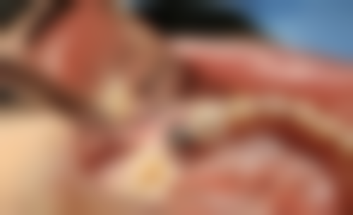 赣南医学校第一附属医院孙秋榕医生技术特色