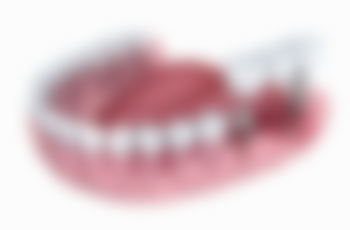 北京雅士美口腔岳熹帆医生擅长项目