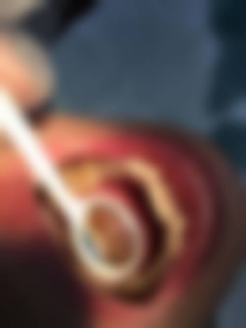 泉州市第一医院李荣华医生的收费价格表