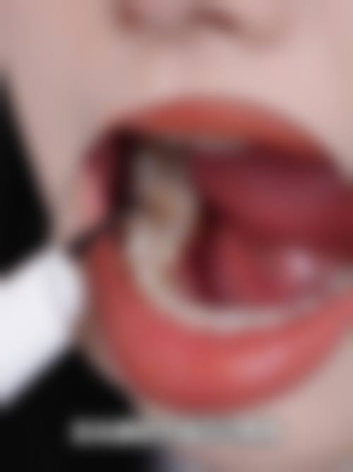 北京协和医院周坚医生口碑评价