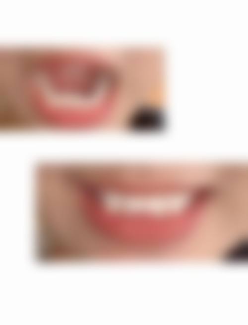 泉州市第一医院李荣华医生擅长项目