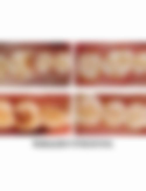 天门市第一人民医院李荣华医生擅长项目