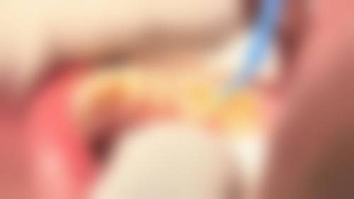 长沙县星沙李荣华口腔诊所李荣华医生简介