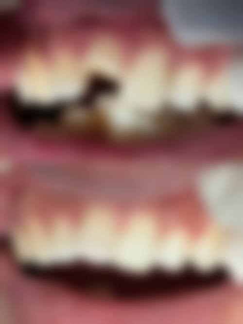 邳州市人民医院李荣华医生擅长项目