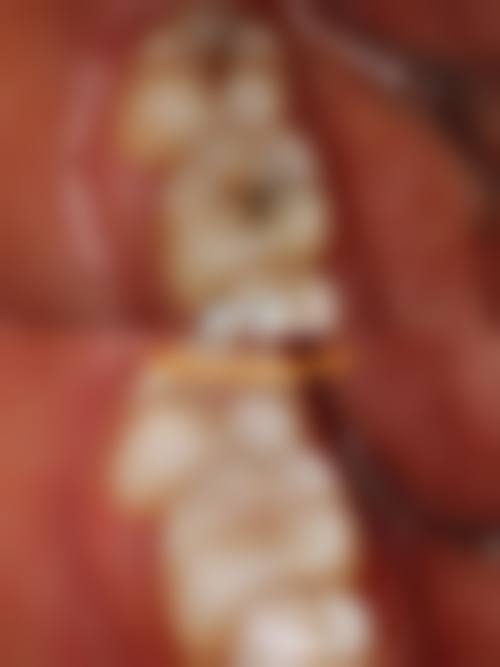 长沙县星沙李荣华口腔诊所李荣华医生技术特色