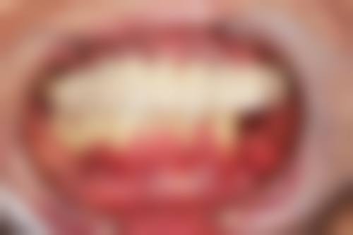 西工第四九龙口腔门诊部、洛阳新意九龙口腔门诊部、洛阳金冠眼科门诊部赵敬博医生技术特色