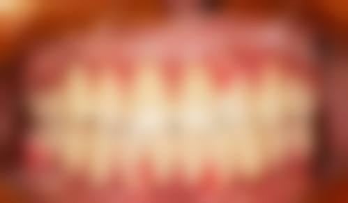 天津市口腔医院王福来医生技术特色