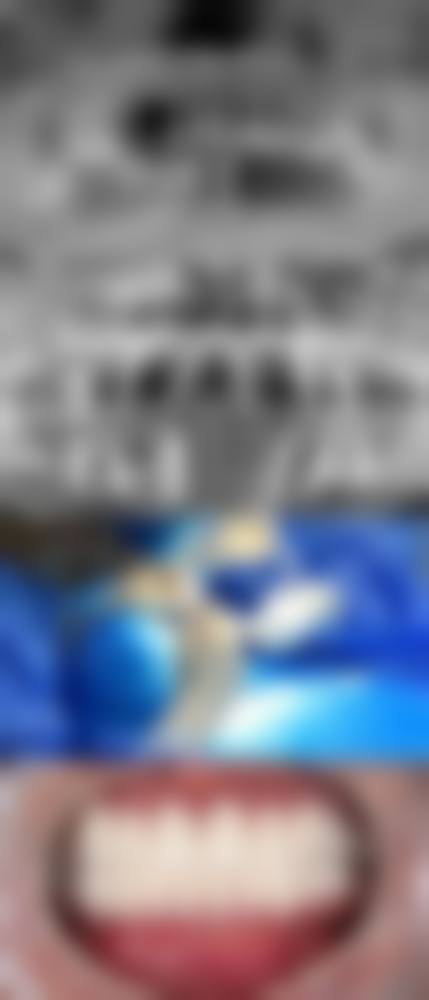 烟台胶东半岛口腔医院王福来医生的收费价格表