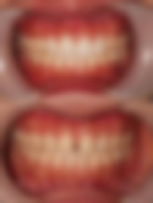 北京佳美医院管理集团股份有限公司三里屯佳美口腔门诊部高仙杰医生口碑评价