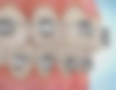 四川南充美昂口腔医院陶波医生口碑评价