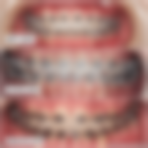 江苏省人民医院溧阳分院陶波医生擅长项目