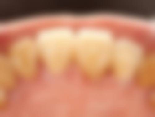 无锡尚美整形美容医院陶波医生口碑评价