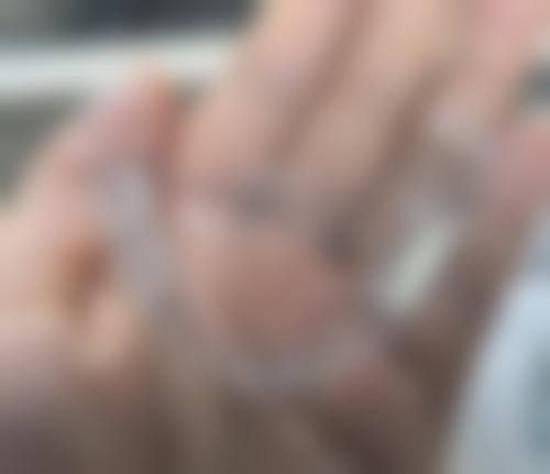 仓山小绵羊卢滨口腔门诊部刘彩娥医生技术特色