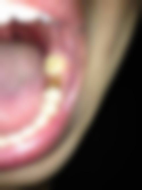 右江民族医学校附属医院李娇娇医生的收费价格表