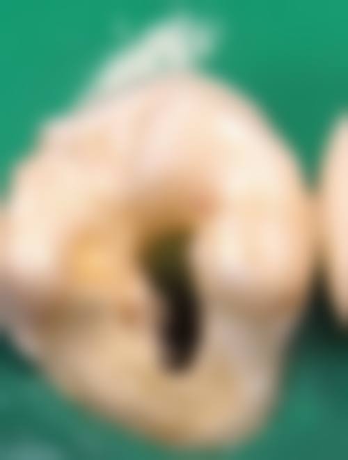 右江民族医学校附属医院李娇娇医生擅长项目