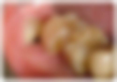 北京协和医院李娇娇医生技术特色