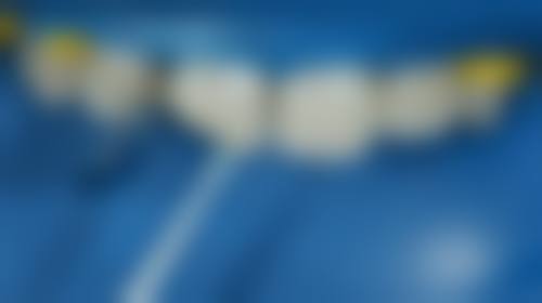 北京协和医院李娇娇医生口碑评价