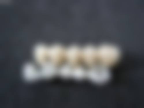 哈尔滨美植口腔门诊部(道外店)王博医生的收费价格表