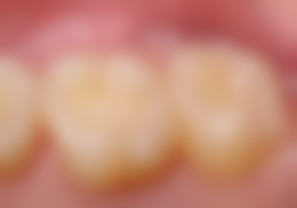 滨州市中医院刘玉梅医生口碑评价