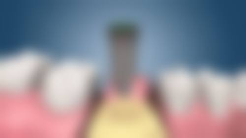 内蒙古包头陈国军口腔诊所医院地址