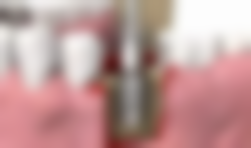 丹阳现代口腔门诊部钱飞医生擅长项目