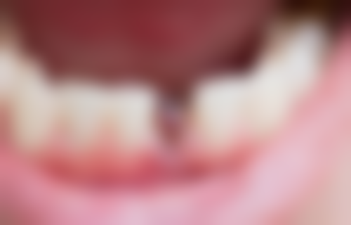 江苏省第二中医院脾胃病科孙志广医生怎么预约挂号