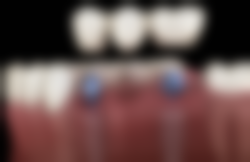 江苏省中医院消化科孙志广医生擅长项目