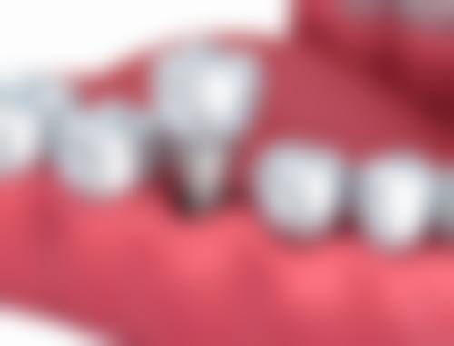 北京中日友好医院张凯医生擅长项目