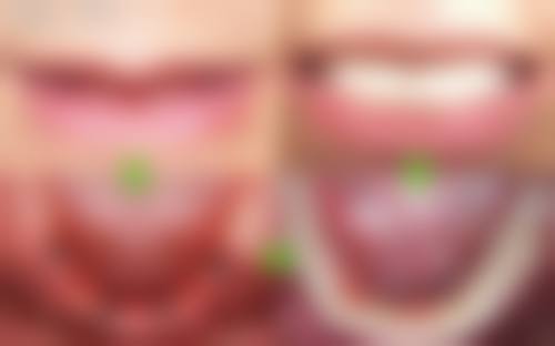 烟台胶东半岛口腔医院王福来医生技术特色