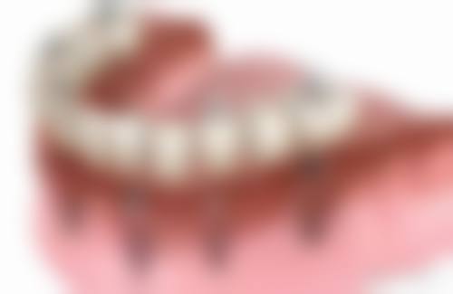 济宁市第一人民医院王福来医生技术特色