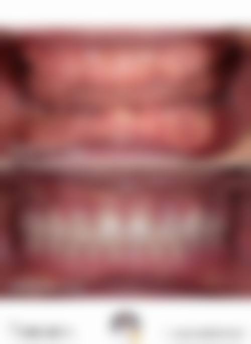 国内医学科学 院肿 瘤医院张凯医生擅长项目