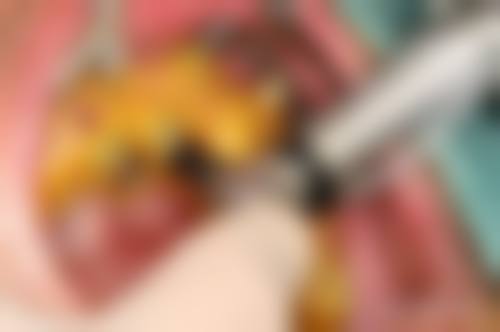 烟台胶东半岛口腔医院王福来医生的收费价格表