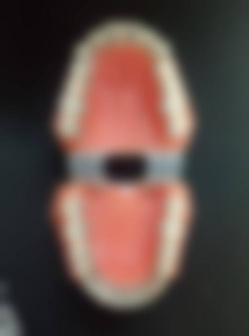 浙江大学医学校附属第二医院李秀珍医生口碑评价