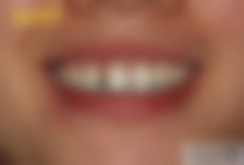 北京中 医 药大学第三附属医院李秀珍医生的收费价格表