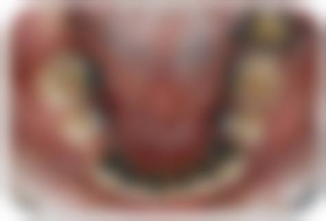 韩国优露牙科医院李秀珍医生口碑评价