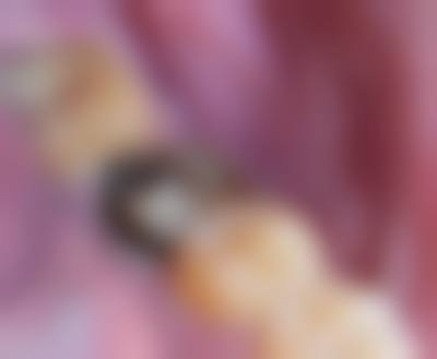 右江民族医学校附属医院李娇娇医生擅长项目