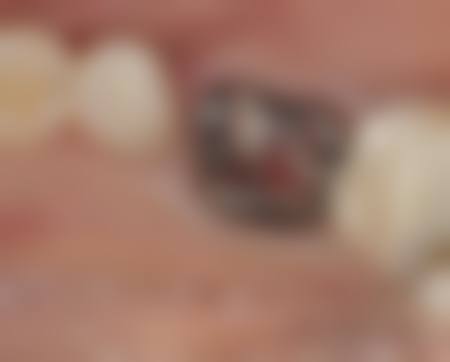 榆林市第一医院李娇娇医生的收费价格表