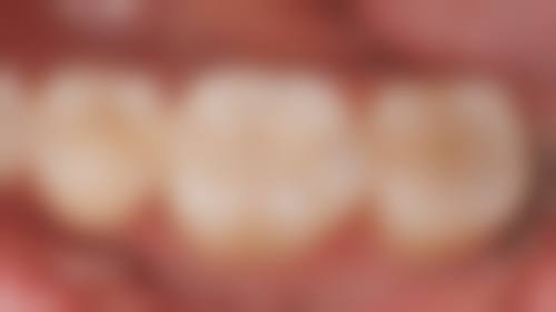 温县人民医院李娇娇医生的收费价格表