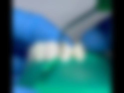 来安县人民医院李娇娇医生擅长项目