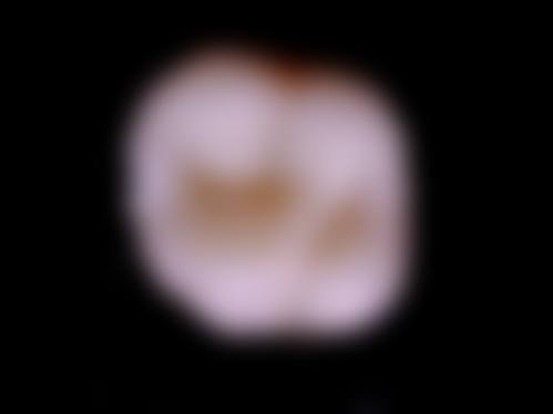 北京协和医院李娇娇医生擅长项目