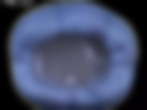 温县人民医院李娇娇医生技术特色