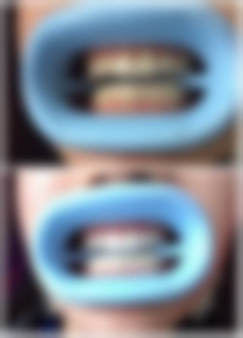 浙江大学医学校附属第二医院李秀珍医生简介