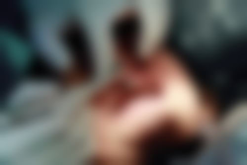 方城万超口腔门诊部杨笑草医生技术特色