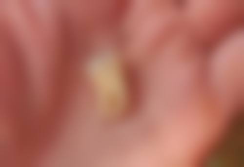 浙江金华东阳亭塘牙科医院预约方式