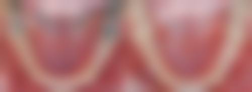 烟台市口腔医院张国田医生擅长项目